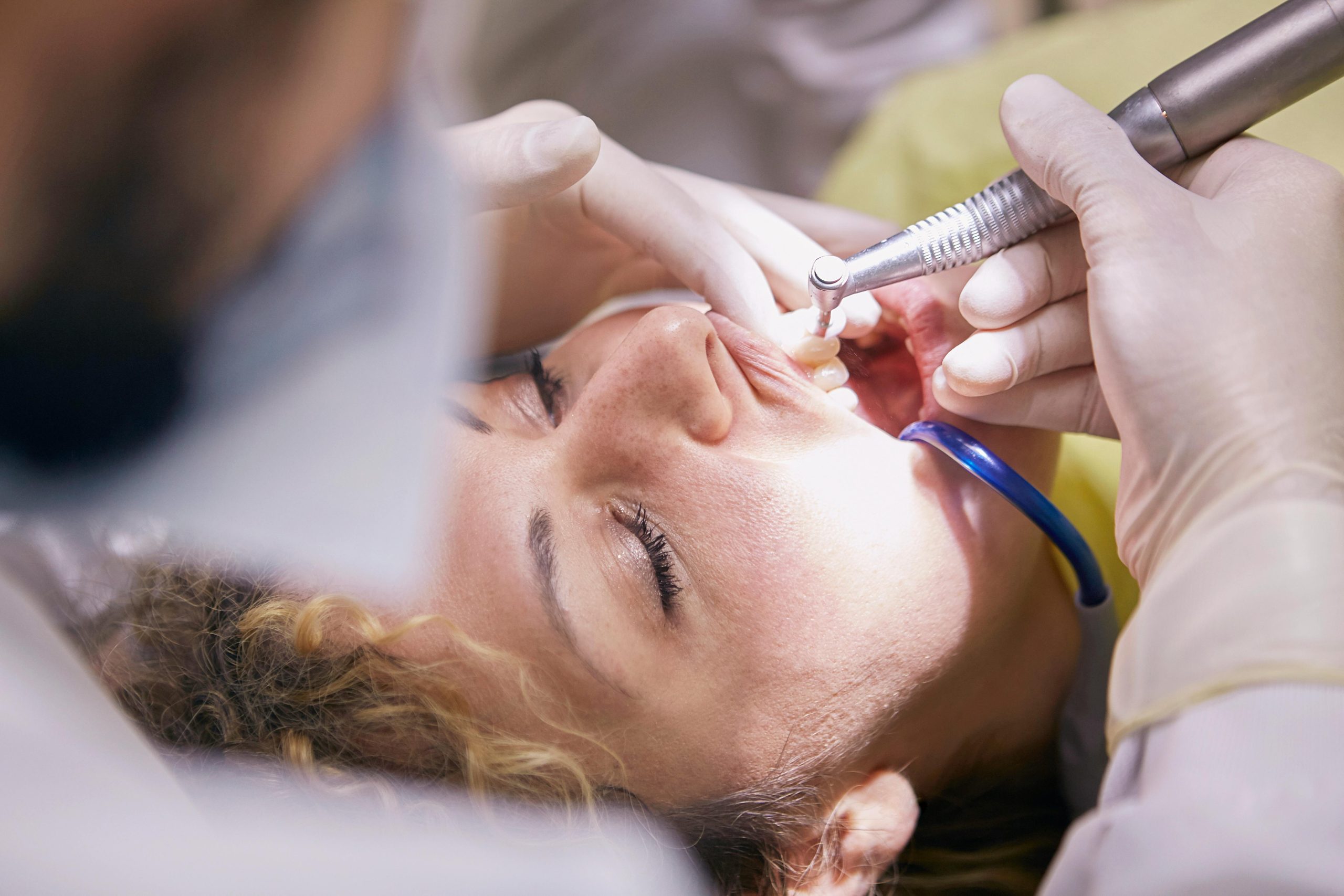 dentist cleaning a patient's teeth